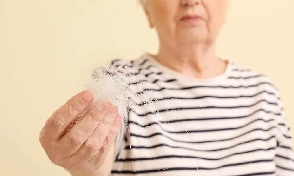 Involutional Alopezie