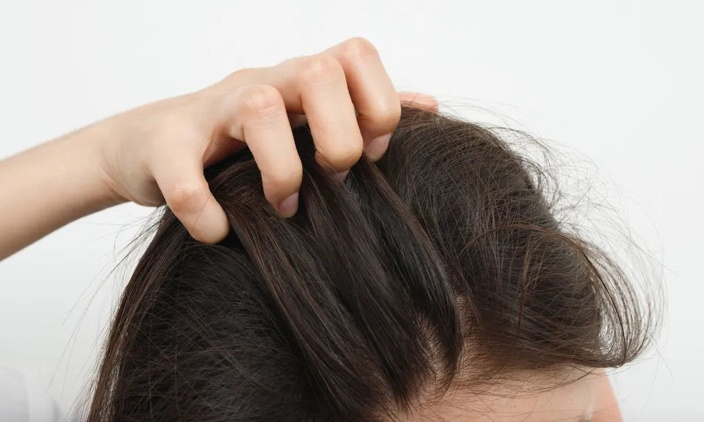 Leiden Sie unter Schuppenflechte auf Ihrer Kopfhaut? Entdecken Sie die Ursachen und Lösungen