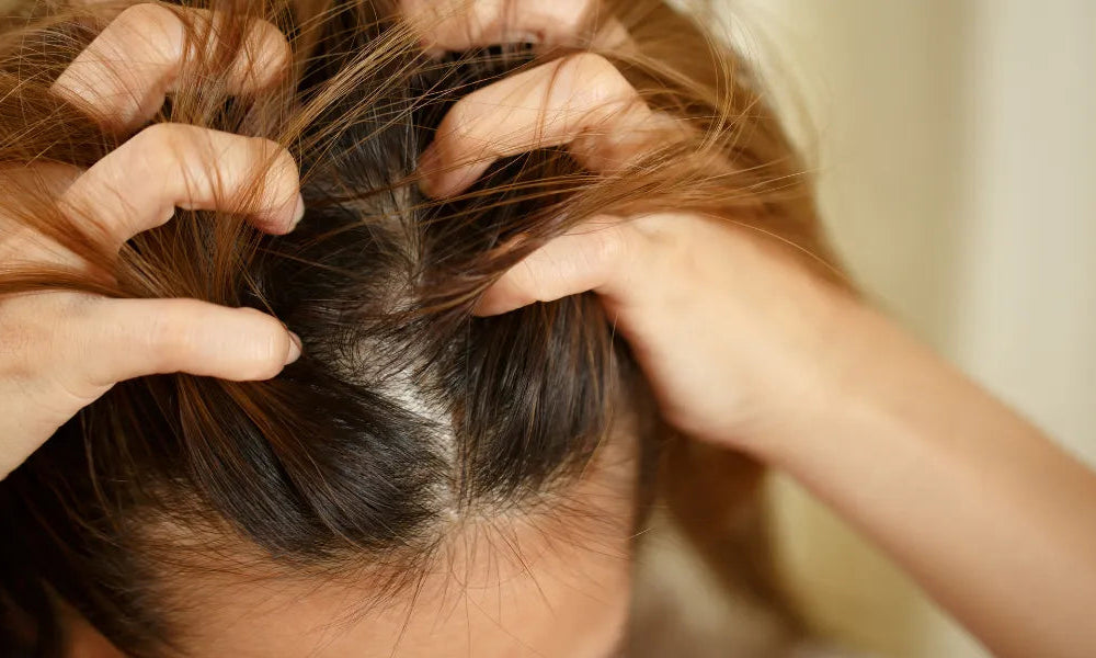 Was tun bei Schorf auf der Kopfhaut?