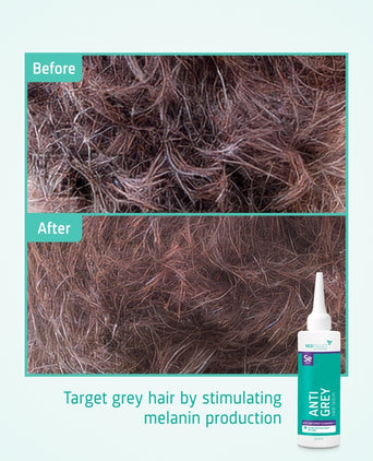 Neofollics Anti-Grau Haarserum Neofollics Anti-Grau Haarserum - Hairgivers
