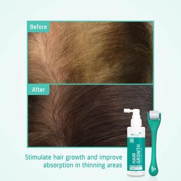 Neofollics Haarwuchs Serum + Roller Neofollics Haarwuchs Kit - Hairgivers