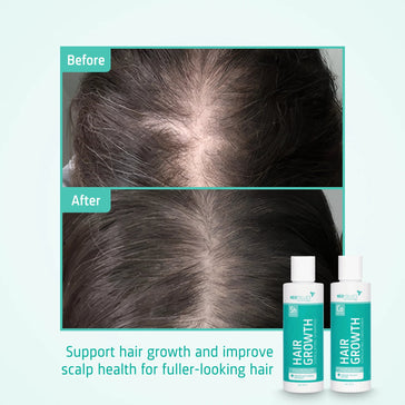 Neofollics Shampoo + Conditioner Starter-Kit Neofollics Shampoo + Conditioner Starter-Kit - Hairgivers