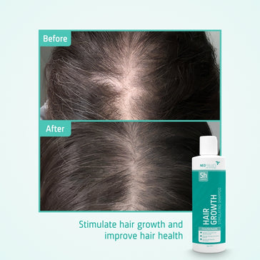 Neofollics Shampoo gegen Haarausfall (250 ml) Neofollics Shampoo gegen Haarausfall (250 ml) - Hairgivers