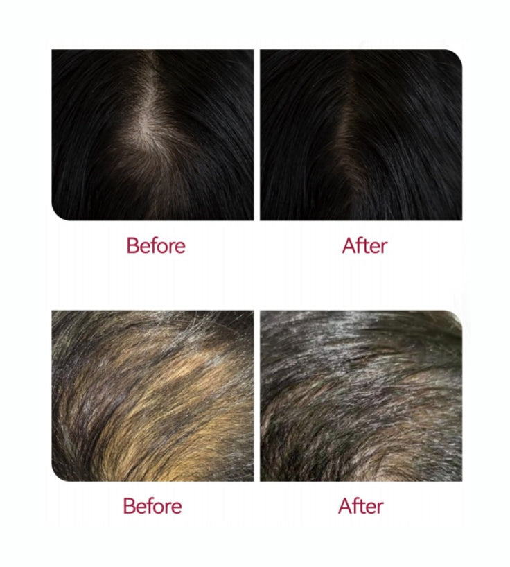 Beaver Anti-Haarausfall Shampoo + Serum + Applikator