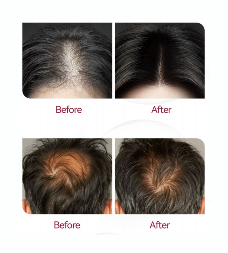 Beaver Anti-Haarausfall Shampoo + Serum + Applikator