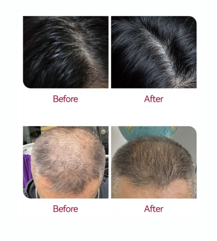 Beaver Anti-Haarausfall Shampoo