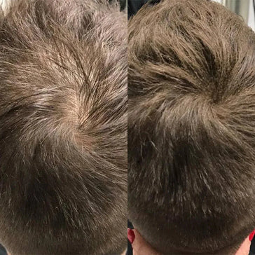 Beaver Keratin Schütthaar (28 gr) Beaver Keratin Schütthaar (28 gr) - Hairgivers