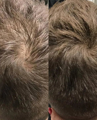 Beaver Keratin Schütthaar - Kastanienbraun (28 gr) Beaver Keratin Schütthaar - Kastanienbraun (28 gr) - Hairgivers