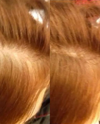 Beaver Keratin Schütthaar - Mittelblond (12 gr) Beaver Keratin Schütthaar - Mittelblond (12 gr) - Hairgivers