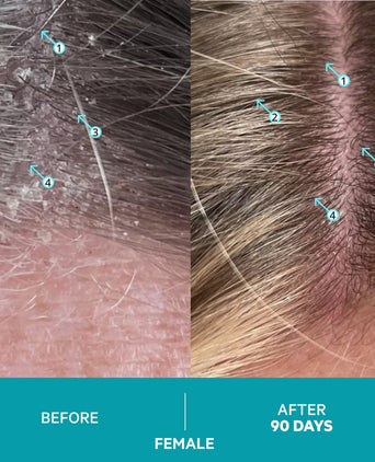 Dandrene Anti-Schuppen Shampoo Dandrene Anti-Schuppen Shampoo