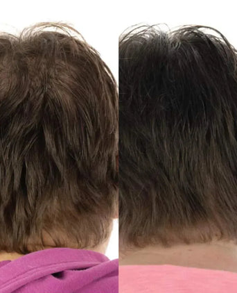 Foligain Shampoo + Conditioner für Frauen (236 ml) Kombi-Packung Foligain Shampoo + Conditioner für Frauen (236 ml) Kombi-Packung - Hairgivers