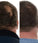 Foligain Shampoo für Männer (473 ml) - Hairgivers
