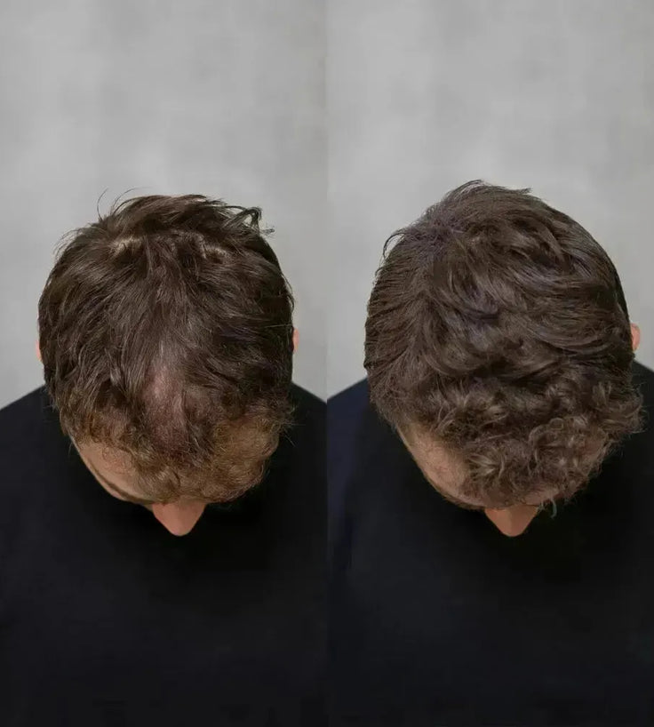 Keratain Pomade + Keratain Streuhaar - Hairgivers