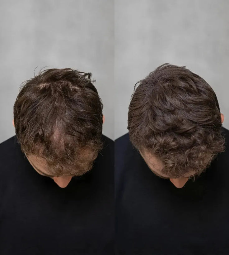 Keratain Streuhaar - Schwarz (25 gr) - Hairgivers