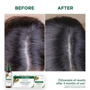 Klorane Anti-Haarausfall-Behandlung Klorane Anti-Haarausfall-Behandlung - Hairgivers