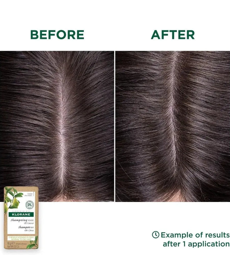 Klorane Shampoo Bar Zedernapfel - fettiges Haar (80 gr) - Hairgivers