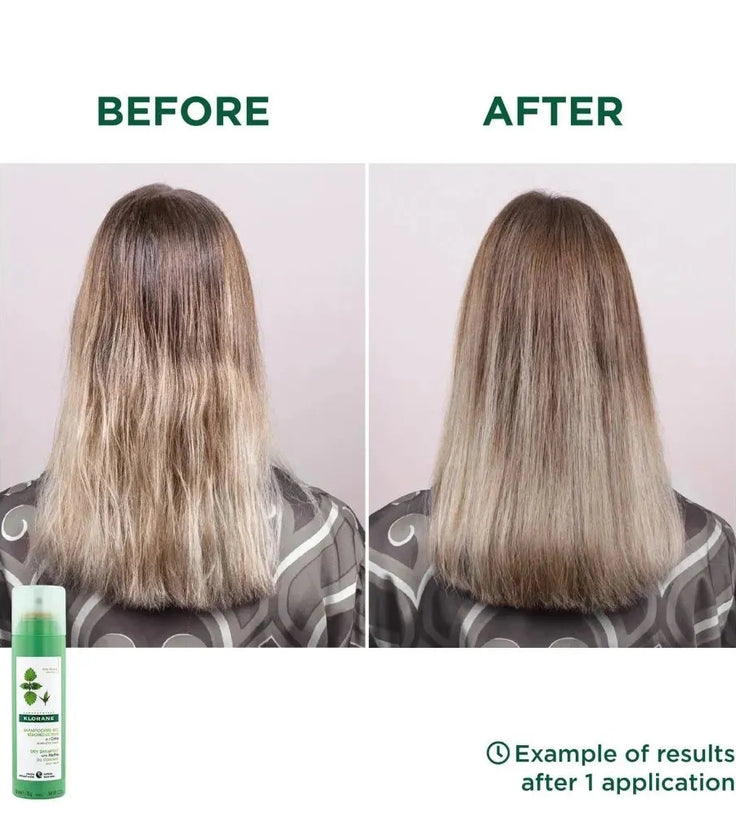 Klorane Trockenshampoo fettiges Haar Brennnessel (150 ml) - Hairgivers