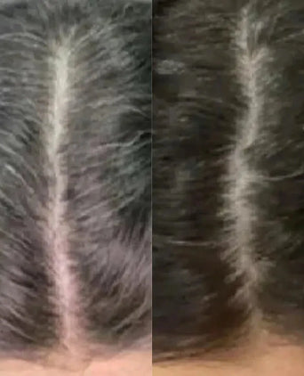 Neofollics Anti-Grau Haartabletten (3-Pack) Neofollics Anti-Grau Haartabletten (3-Pack) - Hairgivers