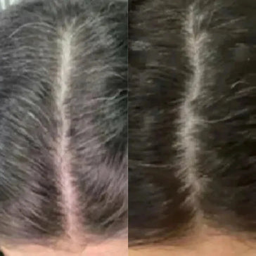 Neofollics Anti-Grau Haartabletten Neofollics Anti-Grau Haartabletten - Hairgivers