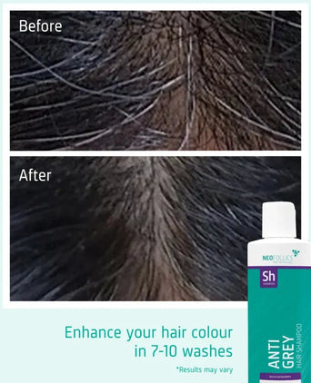 Neofollics Anti-Grau Shampoo Neofollics Anti-Grau Shampoo - Hairgivers