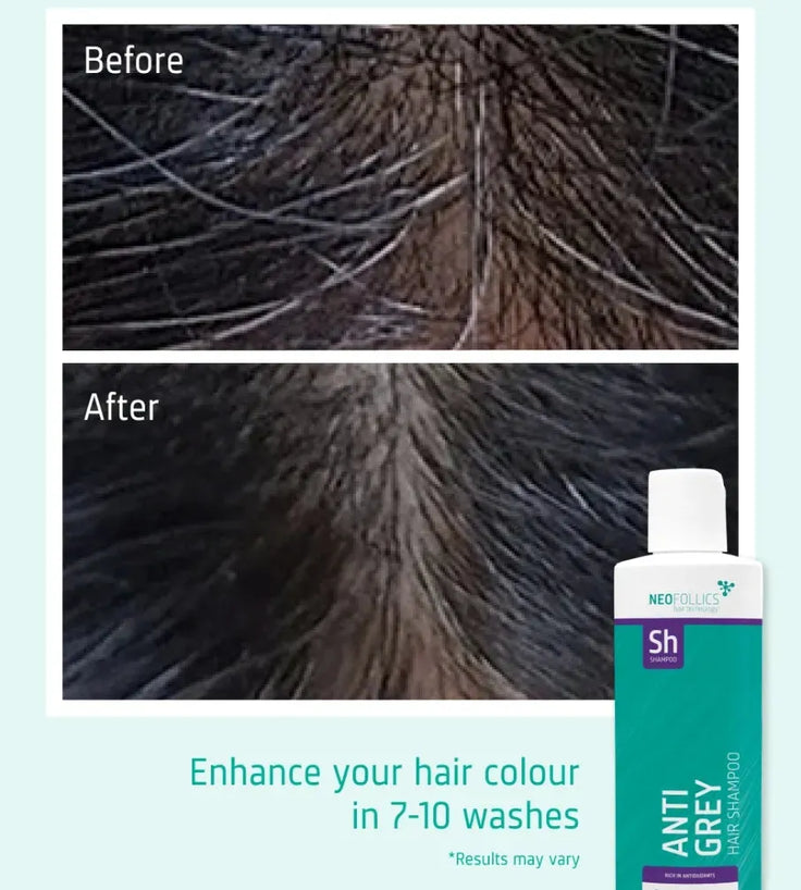 Neofollics Anti-Grau Shampoo - Hairgivers