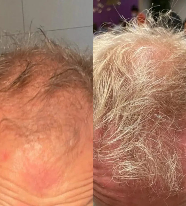 Neofollics Conditioner - Hairgivers