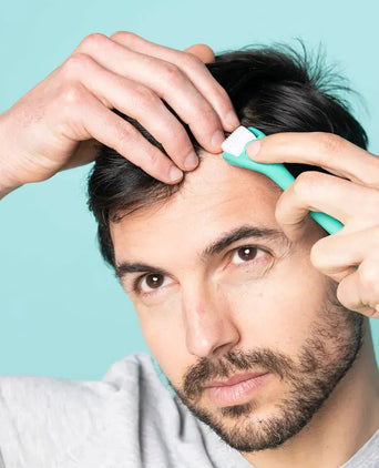 Neofollics Dermaroller (0,3 mm) Neofollics Dermaroller (0,3 mm) - Hairgivers