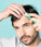 Neofollics Dermaroller (0,3 mm) - Hairgivers