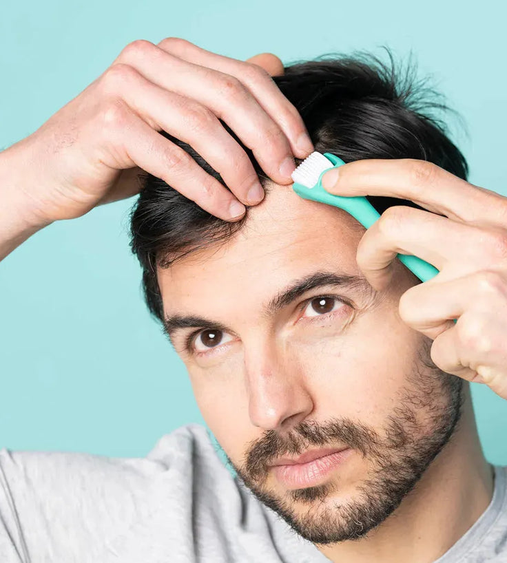 Neofollics Dermaroller (0,3 mm) - Hairgivers