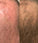 Panthrix Haarwuchs Aktivator 3-Pack (Redensyl) - Hairgivers