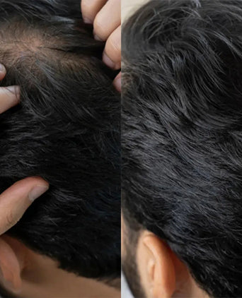 Panthrix Haarwuchs Aktivator (Redensyl) Serum Panthrix Haarwuchs Aktivator (Redensyl) Serum - Hairgivers