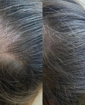 Panthrix Haarwuchs Aktivator (Redensyl) Serum Panthrix Haarwuchs Aktivator (Redensyl) Serum - Hairgivers