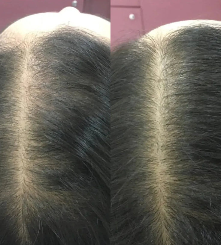 Revita Conditioner (205 ml) - Hairgivers