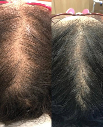 Revita Conditioner (205 ml) Revita Conditioner (205 ml)