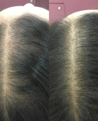 Revita Conditioner (925ml) Revita Conditioner (925ml) - Hairgivers