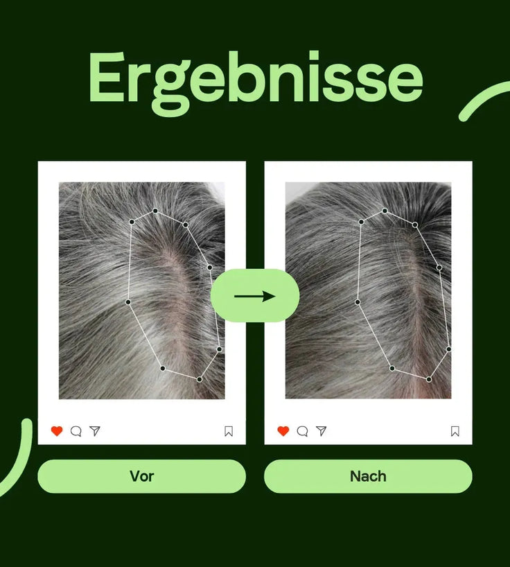 Scandinavian Biolabs Conditioner für Frauen (250 ml) - Hairgivers