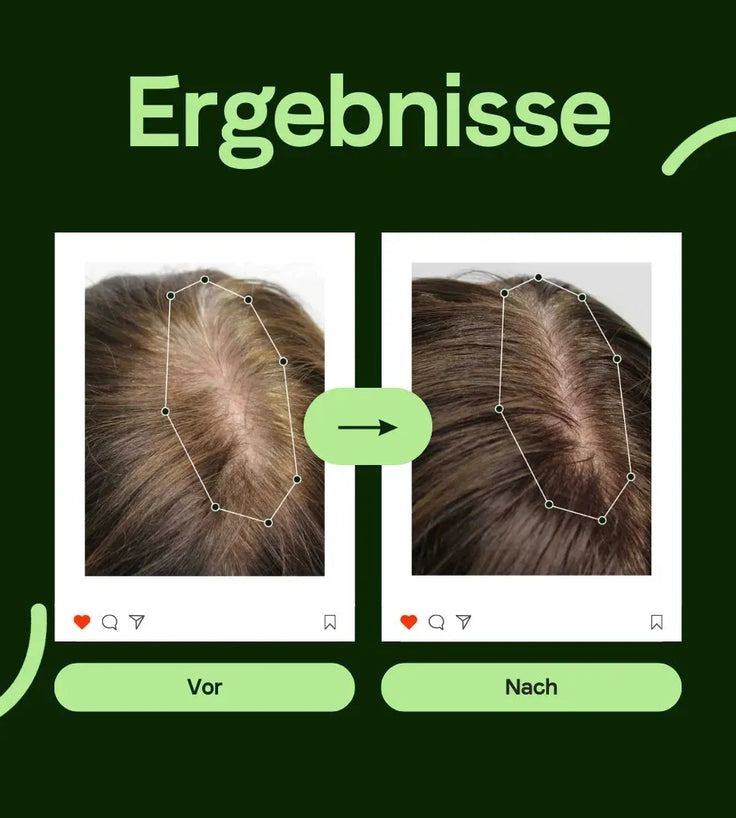 Scandinavian Biolabs Conditioner für Männer (250 ml) - Hairgivers