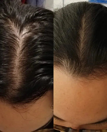 Scandinavian Biolabs Shampoo + Conditioner + Serum (Frau) Scandinavian Biolabs Haarwuchsbehandlung (Frau) - Hairgivers