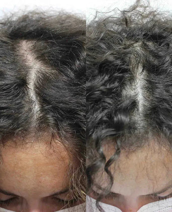 Scandinavian Biolabs Shampoo + Conditioner + Serum (Frau) Scandinavian Biolabs Haarwuchsbehandlung (Frau) - Hairgivers