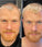 Scandinavian Biolabs Haarwuchsbehandlung (Mann) - Hairgivers