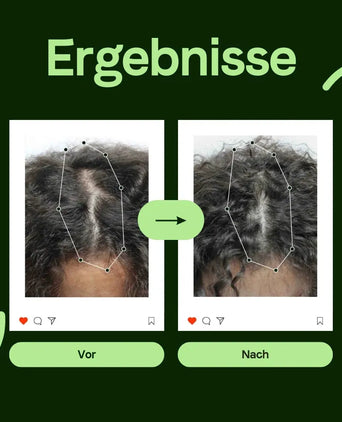 Scandinavian Biolabs Serum für Frauen (100 ml) Scandinavian Biolabs Serum für Frauen (100 ml) - Hairgivers