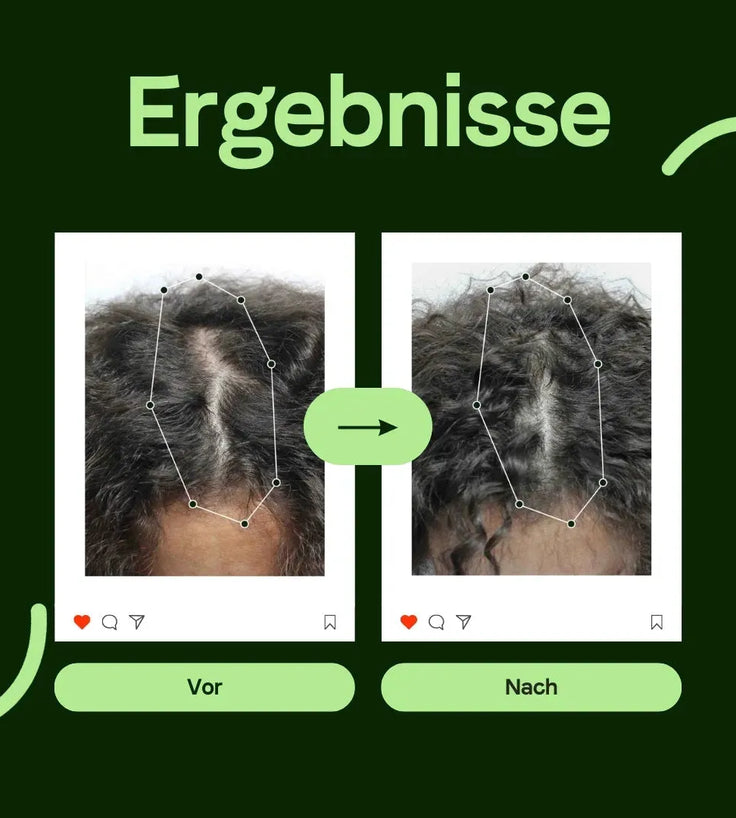 Scandinavian Biolabs Serum für Frauen (100 ml) - Hairgivers