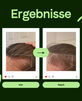 Scandinavian Biolabs Serum für Männer (100 ml) Scandinavian Biolabs Serum für Männer (100 ml) - Hairgivers