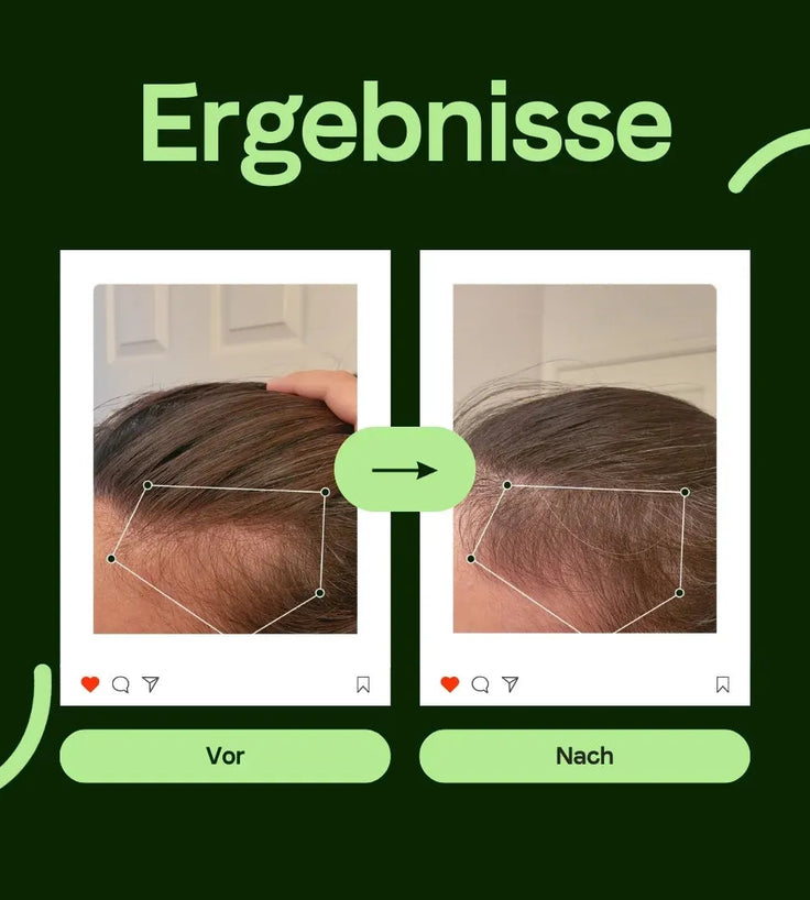 Scandinavian Biolabs Serum für Männer (100 ml) - Hairgivers