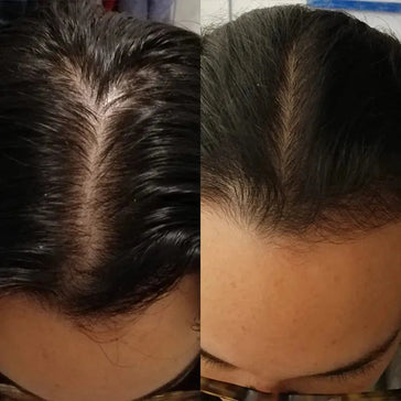 Scandinavian Biolabs Shampoo + Conditioner für Frauen Kombi-Packung Scandinavian Biolabs Shampoo + Conditioner für Frauen Kombi-Packung - Hairgivers