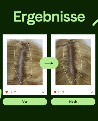 Scandinavian Biolabs Shampoo für Frauen (250 ml) Scandinavian Biolabs Shampoo für Frauen (250 ml) - Hairgivers