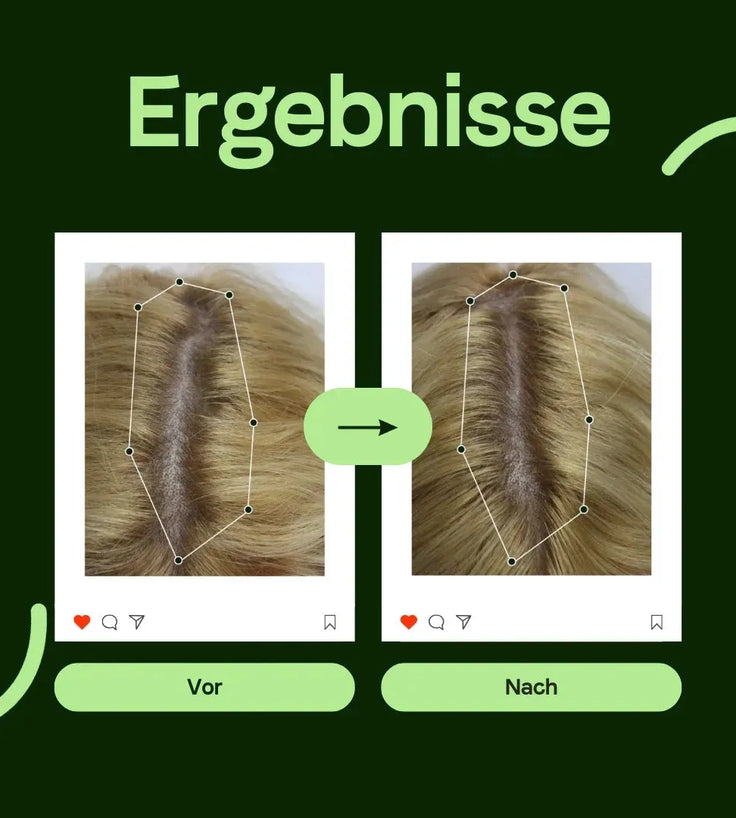 Scandinavian Biolabs Shampoo für Frauen (250 ml) - Hairgivers