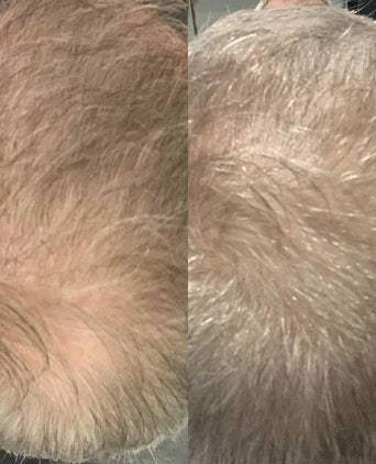 Scandinavian Biolabs Shampoo für Männer (250 ml) Scandinavian Biolabs Shampoo für Männer (250 ml) - Hairgivers