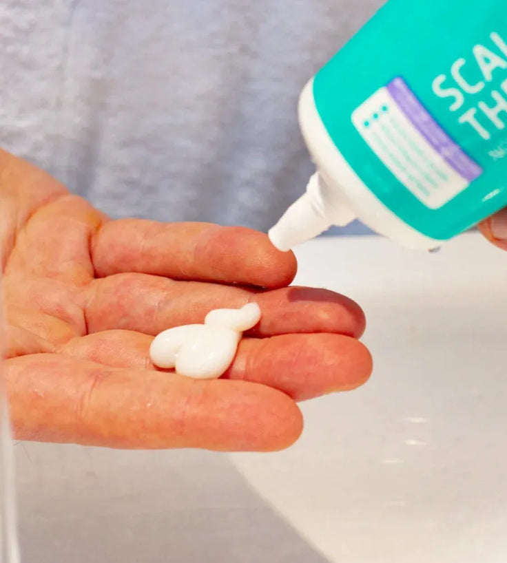 Seborrhoisches Ekzem Kopfhaut Behandlung - Hairgivers