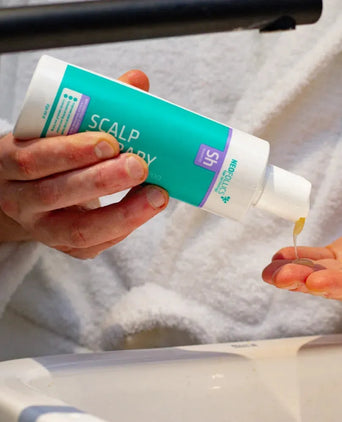 Seborrhoisches Ekzem Kopfhaut Behandlung Seborrhoisches Ekzem Kopfhaut Behandlung - Hairgivers